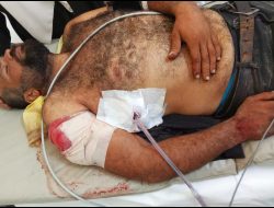 بلال بلبولة في مستشفى ميداني تابع للصليب الأحمر، بعد إصابته. صورة قدمها الشاهد مشكورًا