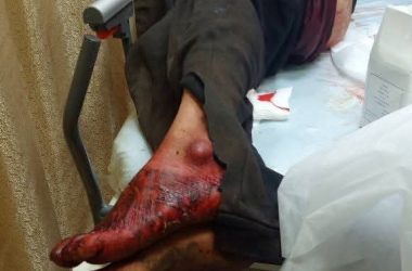 "ق. ن." يتلقى العلاج في المستشفى التركي في طوباس بعد طعنه من قبل المستوطنين، 25.2.25. الصورة قدمتها العائلة مشكورة