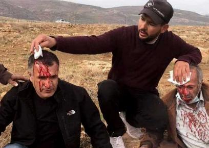 Muhammad Zein a-Din (70) and his son 'Iz a-Din (46) from Majdal Bani Fadel in Nablus District were assaulted by settlers armed with clubs on their way to their fields, 13 Jan. 2021. Photo by Palestine TV