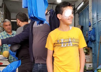 ‘Iz a-Din al-Batsh in the greengrocer’s store where he was working when he was hit. Photo by Manal al-Ja’bari, B’Tselem, 26 April 2021