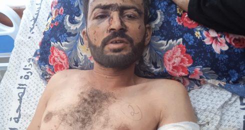 Shadi 'Obeid at a-Shifaa Hospital after his injury. Photo courtesy of the family