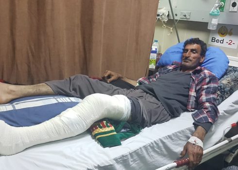 حربي عبده بعد هجوم المستوطنين، 6.5.20. تصوير: صدام صلاح 