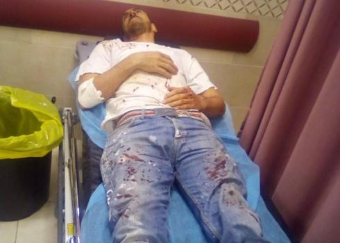 المصاب إياد حسين بعد اعتداء المستوطنين عليه في 16.5.20 