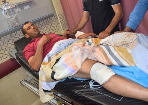 Nassim Haja after settler attack. Burqah, 11 June 2020. Photo: Salma a-Deb'i