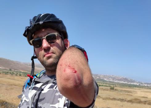 Samer Kurdi, cyclist attacked by settlers near Turmusaya, 18 July 2020. Photo: courtesy of the witnesses 
