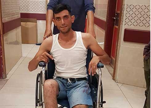 مصطفى مصري بعدما أصيب وفرّ من المستوطنين الذين أطلقوا عليه النار ولاحقوه. حوارة، 11.8.20. تصوير: حسن قادوس