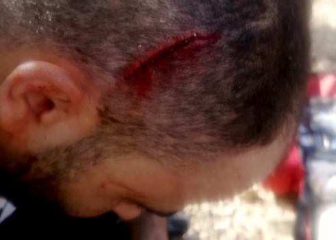 Muhammad Ziben, who was attacked by settlers while working his family’s plot, Burin, 23 Oct. 2020. Photo by Salma a-Deb’i, B’Tselem.  