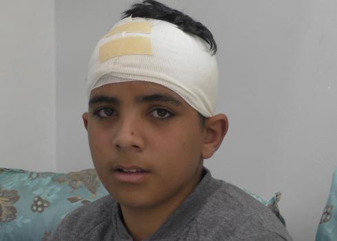 מחמוד א-טמייזי בן ה-13, שנפגע בראשו מאבן שהשליכו מתנחלים על המשאית בה נסע. כביש 60, צומת בין עינון, 21.12.2020. צילום: מנאל א-ג'עברי, בצלם