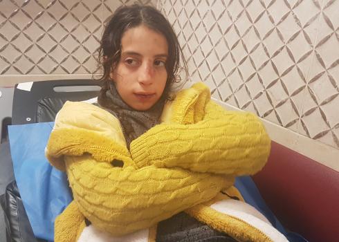 Hala Qut, who was hit in the face by a stone settlers threw at her, Madama, 17 Jan. 2021. Photo: Qut family