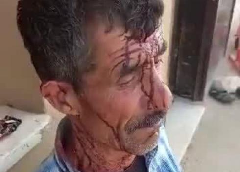 Ibrahim Hamduni after the attack