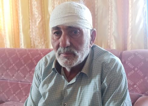 Muhammad Salman after the assault