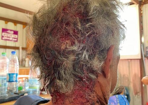 The activist’s head wound. Photo by Emily Glick