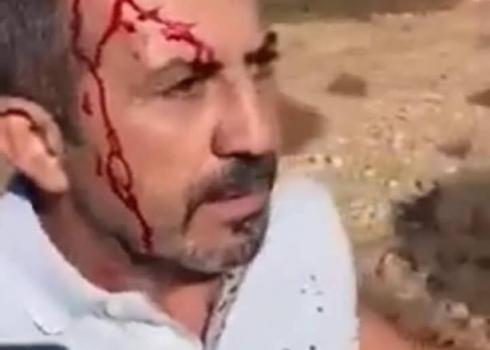 Wael ‘Awis after being hit in the head by a soldier.