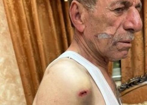 Burhan Jarab after the attack. Photo: Abdulkarim Sadi, B'Tselem, 15 Nov. 2022    