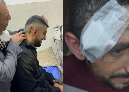 On the right: ‘Abd al-’Aziz after his wound was treated. On the left: Fayez with his head wound 