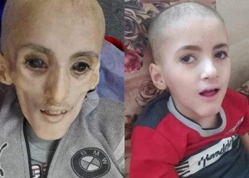 Yazan al-Kafarneh before the war and shortly before he died. Photos courtesy of the family