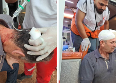 Red Crescent paramedics treat Jihad Masa’ed after settlers injured him in the head. Photo courtesy of community residents, 4 Nov. 2023 