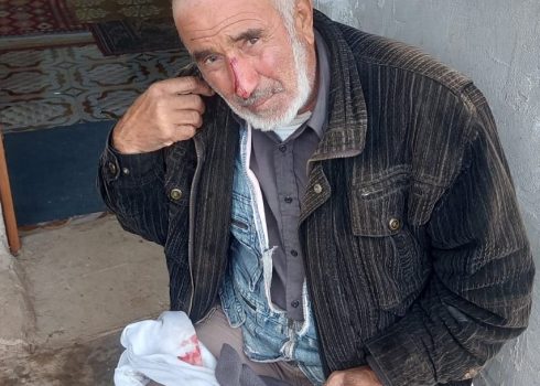 ‘Ali Sabah, wounded in the head when settlers attacked him with a club. Photo courtesy of community residents 