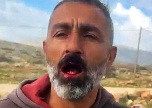 ‘Abdallah Abu a-Sheikh after being attacked by settlers. Photo courtesy of local residents