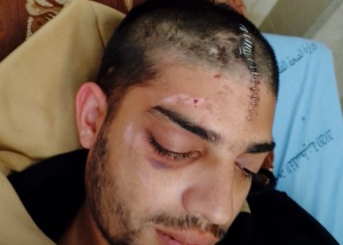 ممدوح سرور بعد اعتداء المستوطنين عليه. تصوير: محمّد رمّانة، بتسيلم