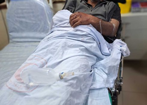 Ghanam al-Faqir in the hospital immediately after the attack. Photo: ‘Aref Daraghmeh, B’Tselem 