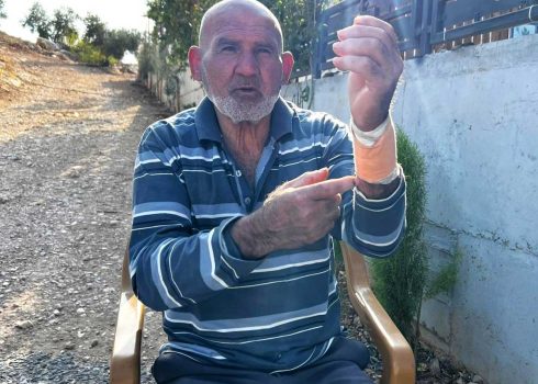 Ibrahim Ghneimat after being attacked. Photo: Basel al-Adrah, B’Tselem