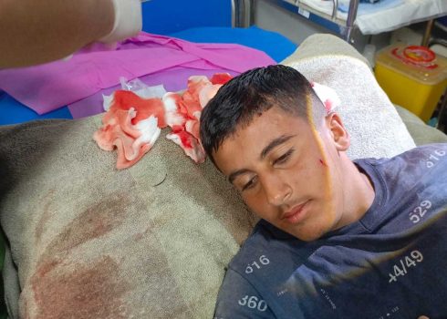 Photo: Mus’ab Suaftah getting his head wound dressed at the Bardalah clinic. Photo: ‘Aref Daraghmeh, B’Tselem