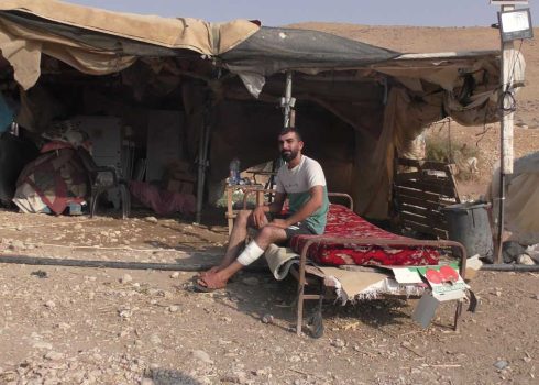 Mustafa Daraghmeh after being assaulted by settlers. Photo: ‘Aref Daraghmeh, B’Tselem