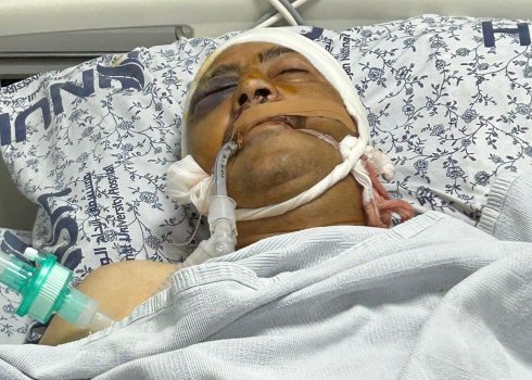 حكمت شتيوي في المستشفى. صورة قدمتها العائلة مشكورة