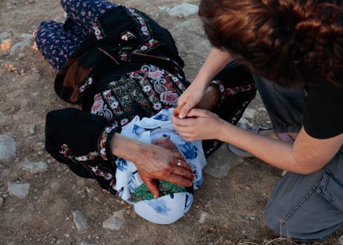 A resident of the village who was beaten by the settlers and hurt by pepper spray. Courtesy of the residents