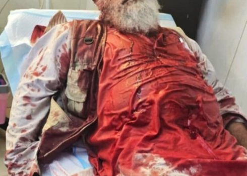 Mustafa Milhem receiving treatment at the hospital. Photo courtesy of Milhem