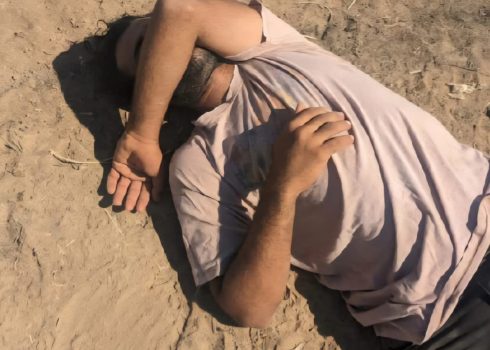 أيمن دراغمة بعد الاعتداء عليه. صورة قدمها السكان مشكورين