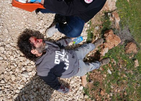 Oded Paporish after the assault. Photo courtesy of the activists