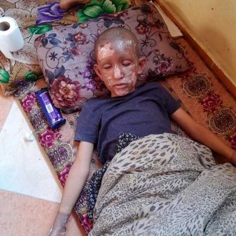 Hani Sharaf in the IDP camp in Khan Yunis. Photo: Olfat al-Kurd, B’Tselem, 7 Jan. 2024 