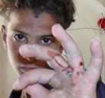 ‘Abd a-Rahman Buraqn after the first incident. Photo: Manal al-Jaabari, B'Tselem, 3 June 2012.